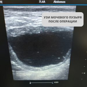 УЗИ мочевого пузыря кошки